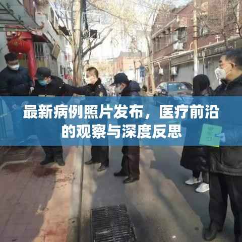 最新病例照片发布，医疗前沿的观察与深度反思